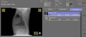 Röntgenbild von Oehm und Rehbein Röntgengerät